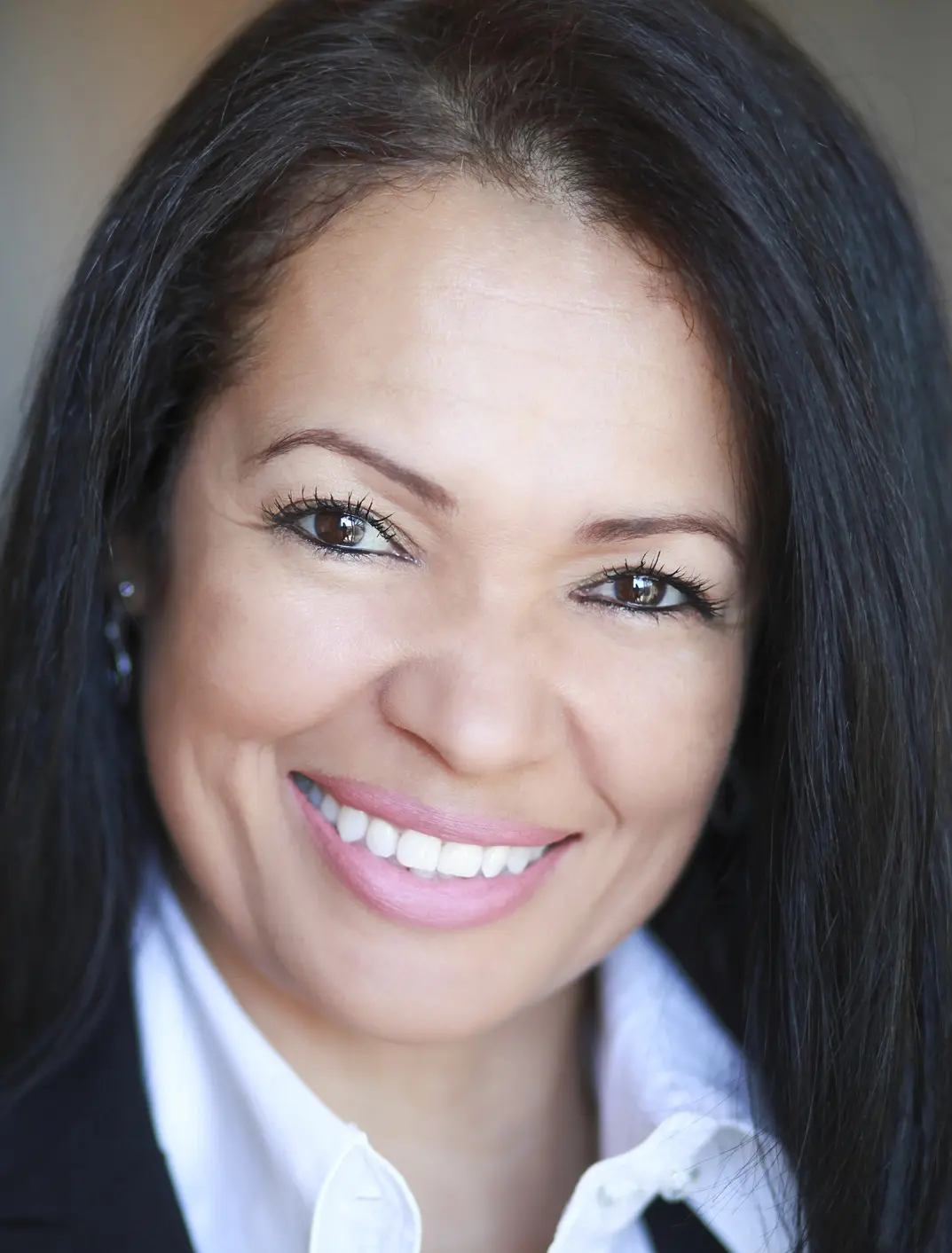 Dental Crowns in Washington, DC