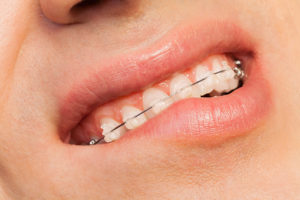 Cosmetic Dentistry in Washington, DC
